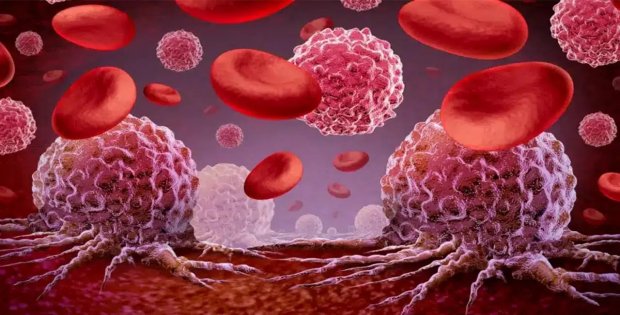 Lenfoma alarmı: Dünya ortalamasından yüzde 25 daha yüksek