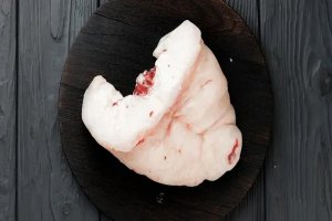 Sağlıklı bir beyin için temel alışkanlıklara dikkat (Dünya Beyin Günü)