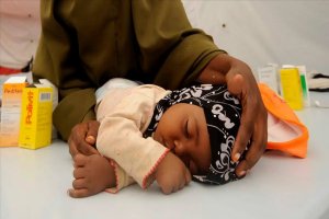 Nijerya'da kızamık salgını